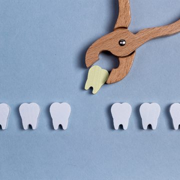 How to Take Care of Your Mouth After Having a Tooth Extraction?